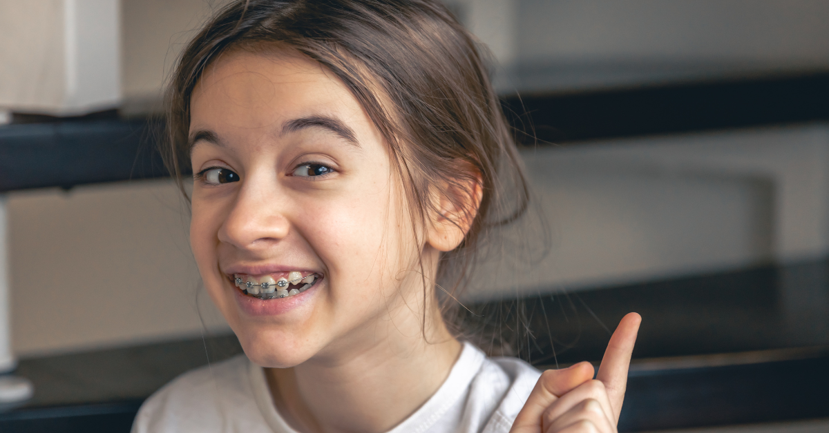 Braces vs Lingual Braces